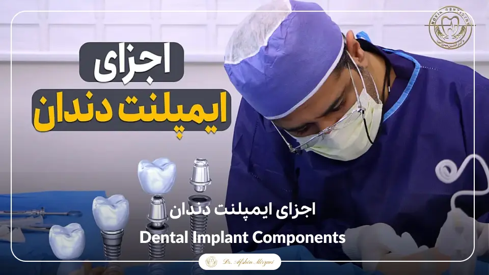 اجزای ایمپلنت دندان-کلینیک دندانپزشکی دکتر افشین میرزایی