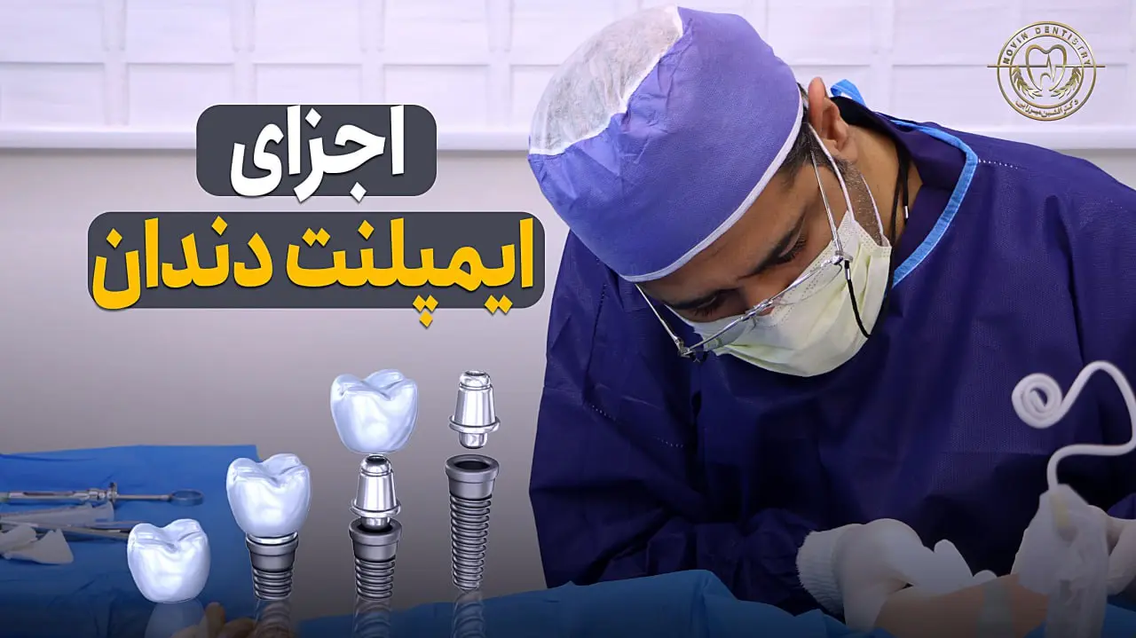 اجزای ایمپلنت دندان 2