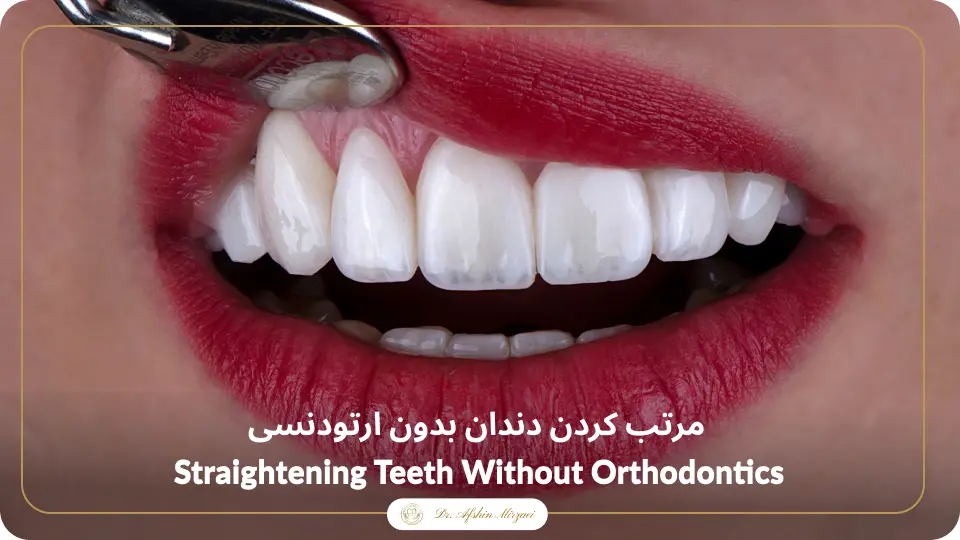مرتب کردن دندان بدون ارتودنسی