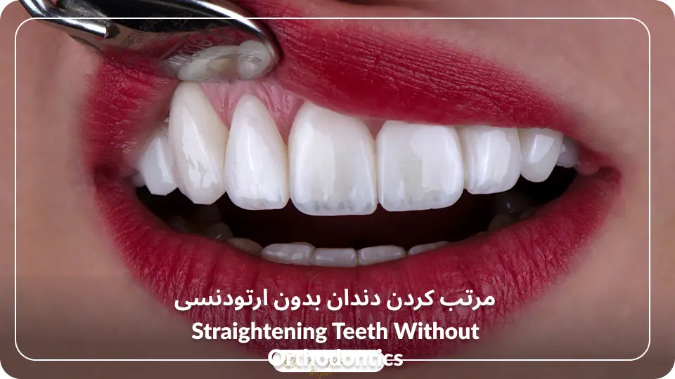 مرتب کردن دندان بدون ارتودنسی