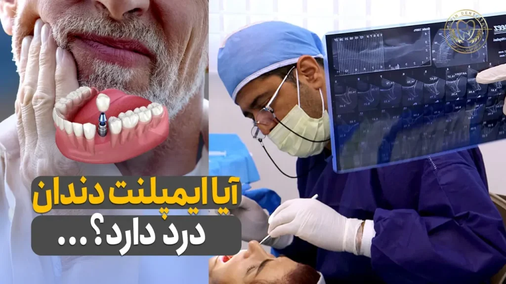 آیا ایمپلنت دندان درد دارد؟- ایمپلنت دیجیتال