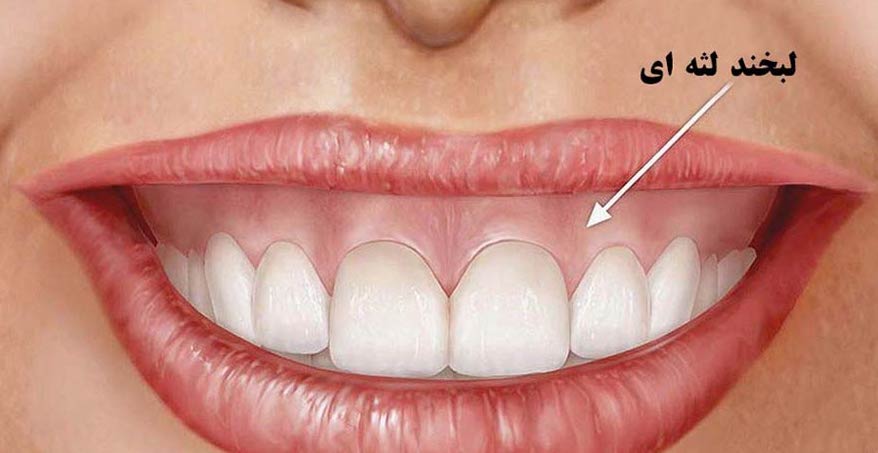 Shape Your Smile3 1 کلینیک دندانپزشکی دکتر افشین میرزایی