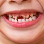 مایع ارزان قیمت که پوسیدگی دندان را کنترل می‌کند