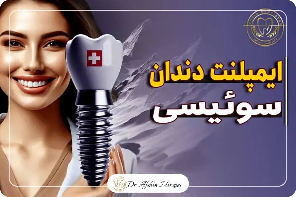 ایمپلنت دندان سوئیسی در کلینیک دندانپزشکی دکتر افشین میرزایی