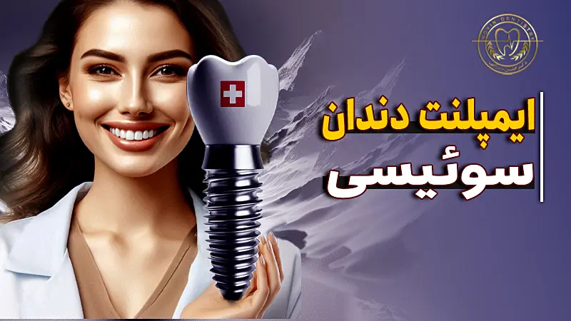 ایمپلنت سوئیسی-ایمپلنت دندان برند سوئیسی-دندانپزشکی تهرانپارس