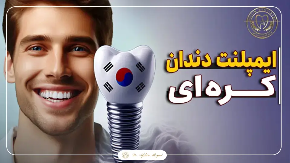 ایمپلنت کره ای - کلینیک دکتر افشین میرزایی