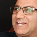 کلینیک دکتر افشین میرزایی 7 Alireza shams Full Implant Top and Bottom