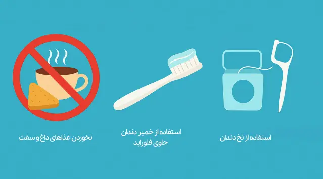 جرمگیری دندان با دستگاه اولتراسونیک 4 مراقبت های بعد از جرمگیری دندان- دندانپزشکی دکتر افشین میرزایی