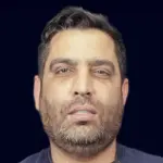 کلینیک دکتر افشین میرزایی 10 مصطفی همتی-لمینت دندان