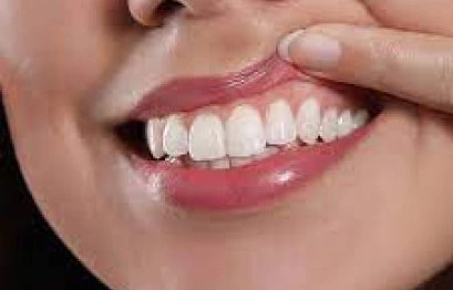 ۸ توصیه مهم برای مراقبت از پروتز دندان | راهنمای بیماران بعد از پروتز Gum care - ۸ توصیه مهم برای مراقبت از پروتز دندان | راهنمای بیماران بعد از پروتز | کلینیک دکتر میرزایی